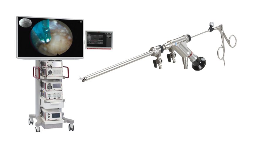 4K Spinal Endoscopy