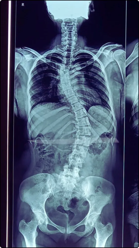 Before surgery